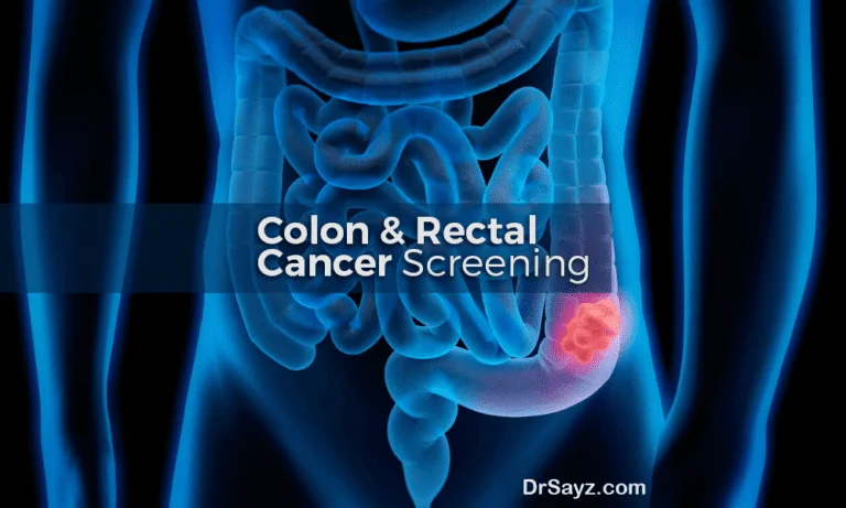 colorectal cancer