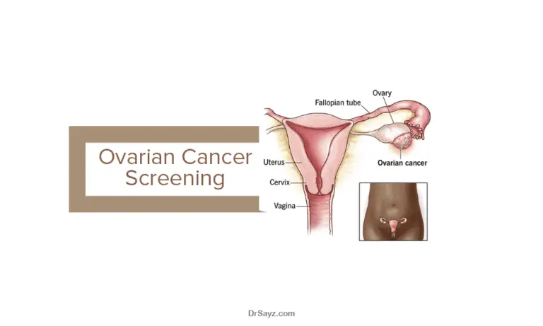 ovarian cancer screening